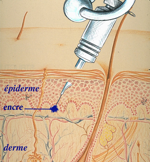 principe tatouage aiguille peau