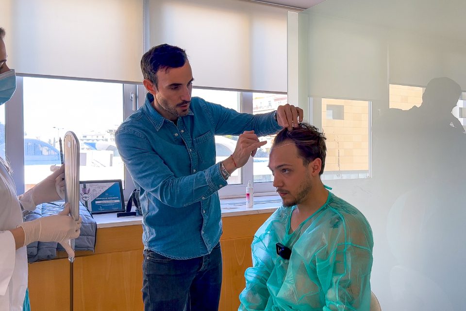 Monsieur cheveux avant operation